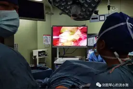为手术刀装上“导航”！荧光腹腔镜助肿瘤显形，这些病人最受益图片