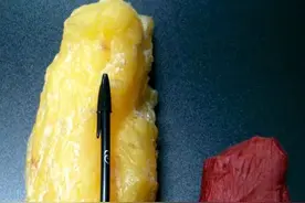 体脂率大于这个数，你就危险了！一个健康有效的减脂方法图片