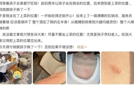 别再抹牙膏、酱油、白酒了！烫伤急救“五字诀”了解一下图片