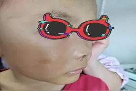 厦门一男童流鼻血、发高烧，“元凶”每家都在用！千万小心！图片