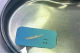 小伙腹痛难忍，原来是误食异物扎破了胃图片