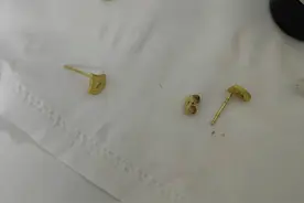 小小耳洞 散发 大大异味，咋回事？图片