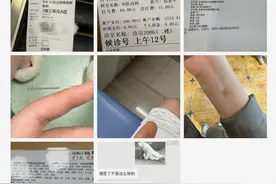 嘴唇干裂、起皮，当心“元凶”可能是这种疾病的信号！图片