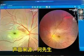 95后宝妈一觉醒来，右眼“瞎了”！医生：警惕这个先兆→图片