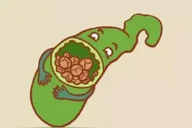 B超报告说有胆结石，为啥 CT检查又说没有呢？让我们“医”探究竟图片