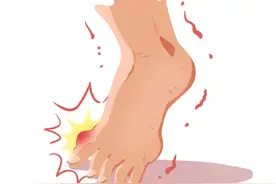 得了痛风，应该吃些什么？尿酸高还能运动吗？一篇带你了解如何科学应对痛风→图片