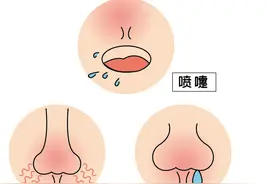 鼻子为何老是堵？原因和应对方法看过来～图片