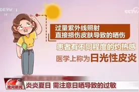 皮肤红肿、瘙痒？你可能“对太阳过敏”！防护指南快查收→图片