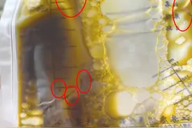 警惕！广东阿叔腹痛难忍，密密麻麻的虫子堵住了胆管……医生：很多人爱吃图片