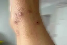 别拿蚂蚁不当虫子，被咬一次就“要命”！图片