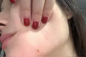 “上海一女子禁烟场所被烟头烫伤脸部”进展：受伤女子获赔付，双方达成和解图片