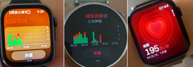 医生！智能手表预警说我心脏有问题，我好慌…咋个办？！