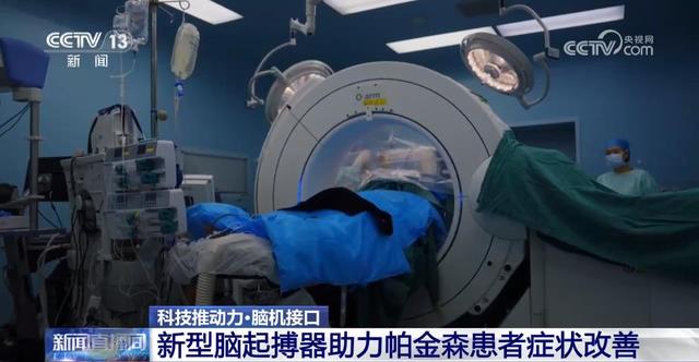 我国脑机接口技术走向临床 受试者体验如何？