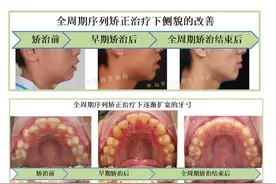中山市口腔医院口腔正畸科：全周期颜面管理，守护健康与自信图片