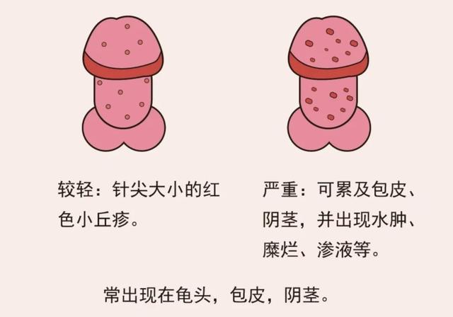 丁丁红肿、瘙痒、长红点，是怎么回事？