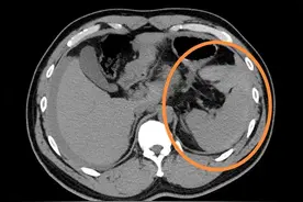 大爷骑车摔倒后，这里竟然“裂开”了……图片