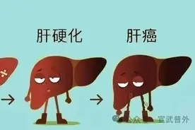 什么是“肝癌三部曲”？图片