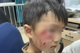 警方提级调查！3岁男童被狗咬伤打了疫苗仍离世，最新进展→图片