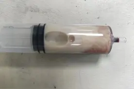 连吃几天，福州小伙突发腹痛，进ICU抢救！医生：很多人这样吃真会要命→图片