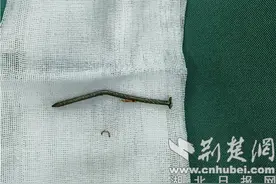 气钉枪“走火” 四厘米钢钉射进右脚踝图片