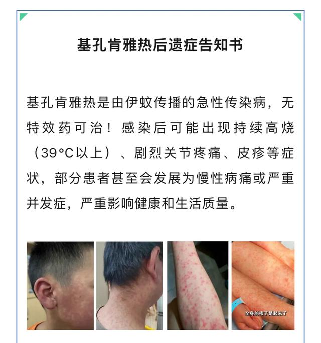 基孔肯雅热“后遗症”到底怎么回事