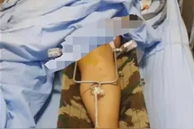 成都15岁女孩KTV陪酒后坠楼重伤，警方已刑事立案，母亲：一直以为她在火锅店上班图片