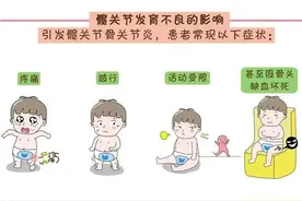 及早进行超声检查  筛查婴幼儿髋关节发育不良图片