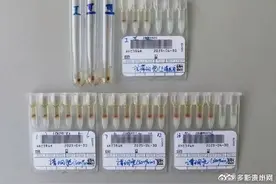 云南发现1例罕见恐龙血图片