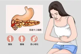 动静医生 | 假日厨房，警惕“胰腺危机”：“五一”小长假合理饮食攻略图片