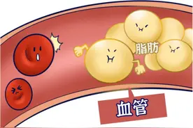 体重不过百也会得高血脂？这些人群需重点关注！图片