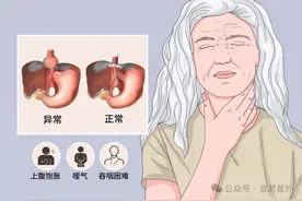剧烈咳嗽因何在？——原来是“疝”惹了祸图片