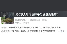 内衣袜子混洗，60岁男子确诊感染！医生：这3件事要特别注意图片