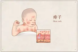 痱子又痒又疼？防痱攻略来了图片