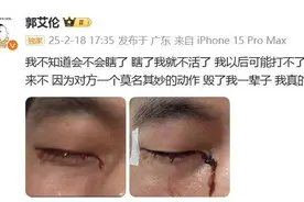 热闻|郭艾伦眼睛受伤疑似“结膜破碎”，俱乐部称在“复盘和反思”，医生：不要太忧心图片