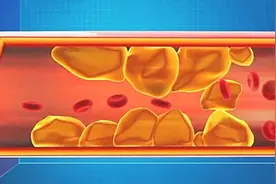 屁股长这样，可能更长寿！每天拍拍臀，血液通畅、强身防病…图片