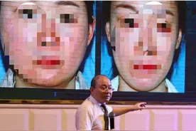 百名整形大咖齐聚东莞：“锥子脸”已过时，“幼态脸”正当道图片