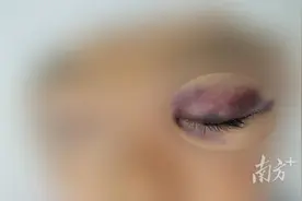 8岁男童跌落致脑血肿！寒假临近，警惕这种易被忽视的伤害图片