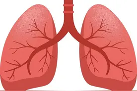 母女同患“肺炎”竟和家中鹦鹉有关？这种病严重可危及生命图片