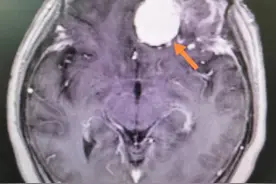 女子参加葬礼后突然晕厥，醒来直念叨“有鬼”！医生检查后发现……图片