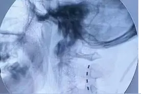 28岁“植物人”被唤醒！这一创新性治疗点燃康复希望图片