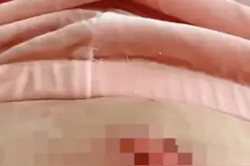 一觉醒来，女子肚皮撕掉一块！“取暖神器”有风险……图片