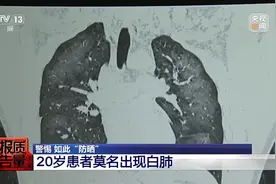 警惕！已有人“白肺”，夏天很多人都在用……图片