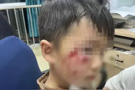 警惕犬只伤人 被犬袭击后这样处理→图片