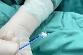 可逆、突破角膜限制，成都普瑞眼科引领EVO ICL晶体手术新潮流图片