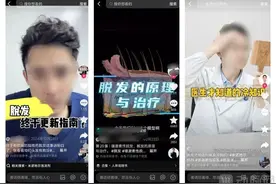 上市30年防脱老药，依靠年轻群体成就10亿级大单品图片