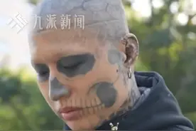 形似骷髅！面部文身6年小伙决定洗掉：很后悔，没法找工作图片