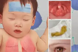 “毒王”腺病毒来袭，儿科专家说这个时间点最关键图片