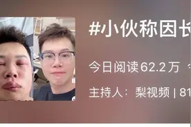 长期抠鼻子，小伙感染“丹毒”面部肿胀，“丹毒”到底是什么毒？图片