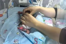 三胞胎奇迹诞生，医者仁心续写生命华章图片