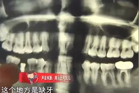 矫正牙齿效果不理想 塞恩口腔同意退款后又变卦了图片